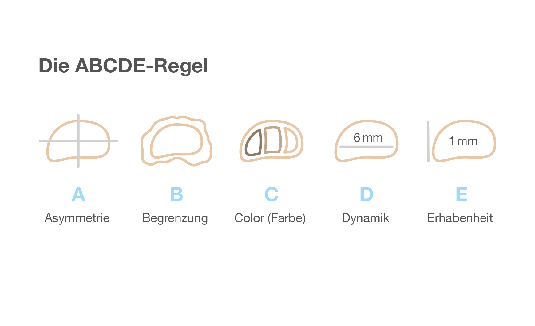 Die ABCDE-Regel bei Hautkrebs