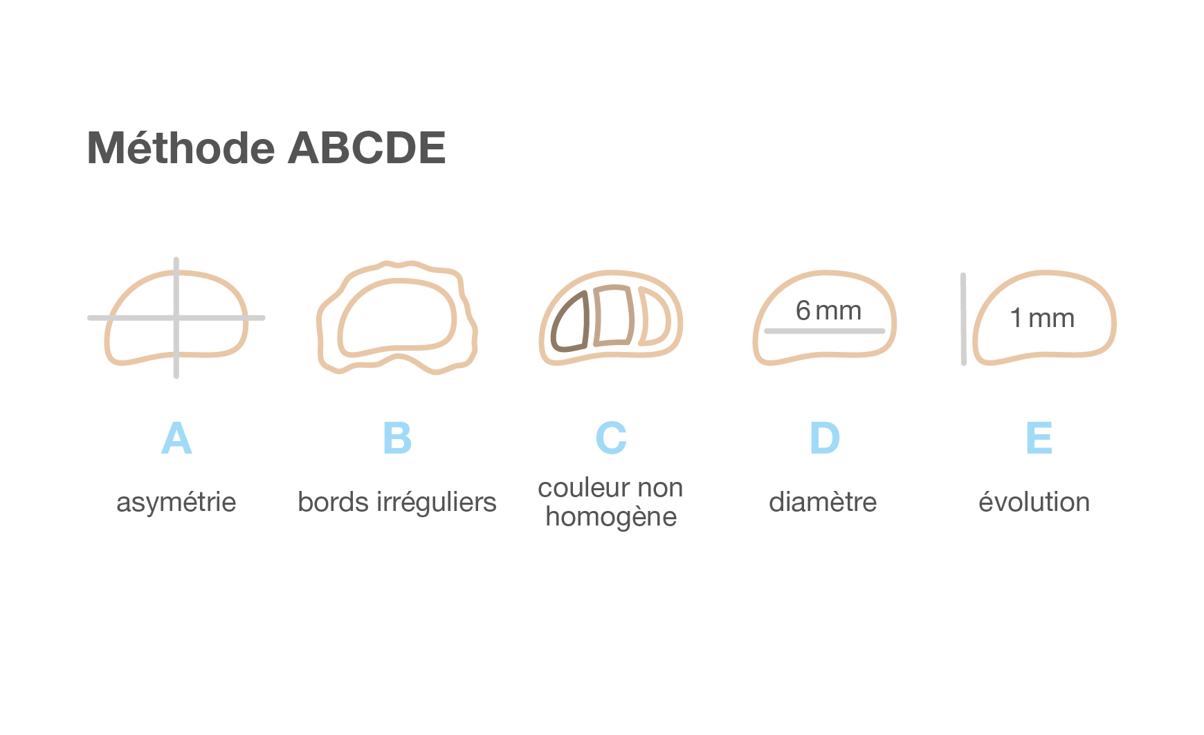 La règle ABCDE en cas de cancer de la peau