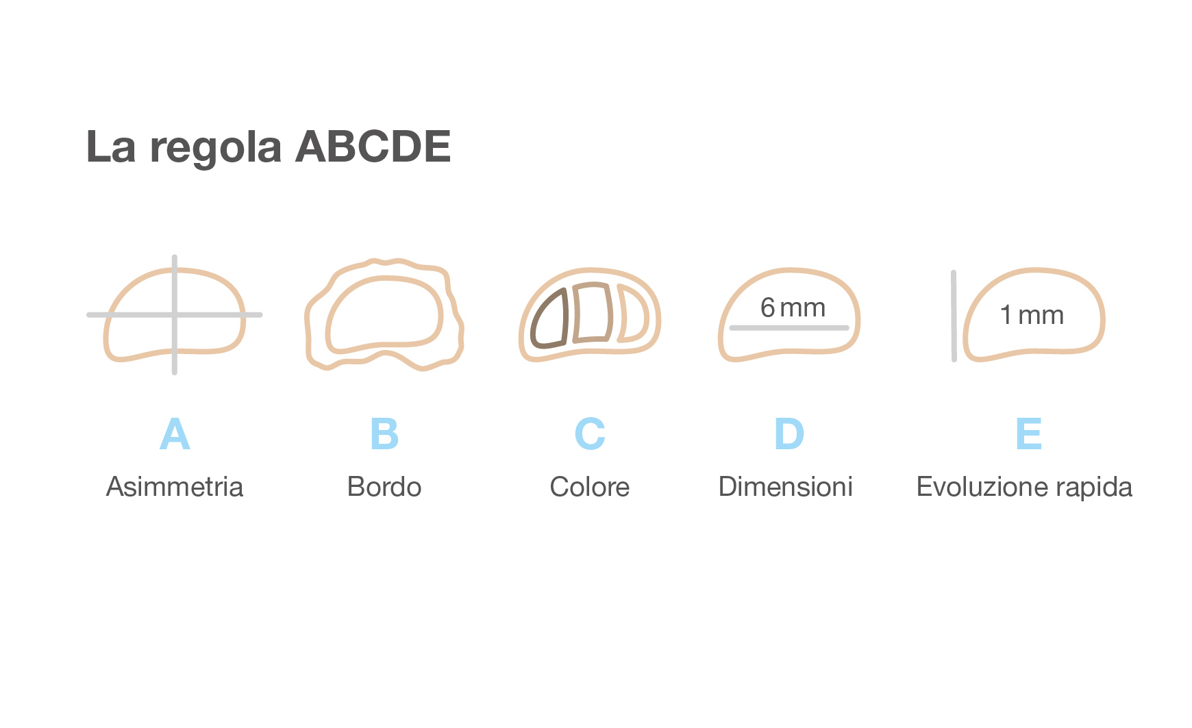 La regola ABCDE per il cancro della pelle