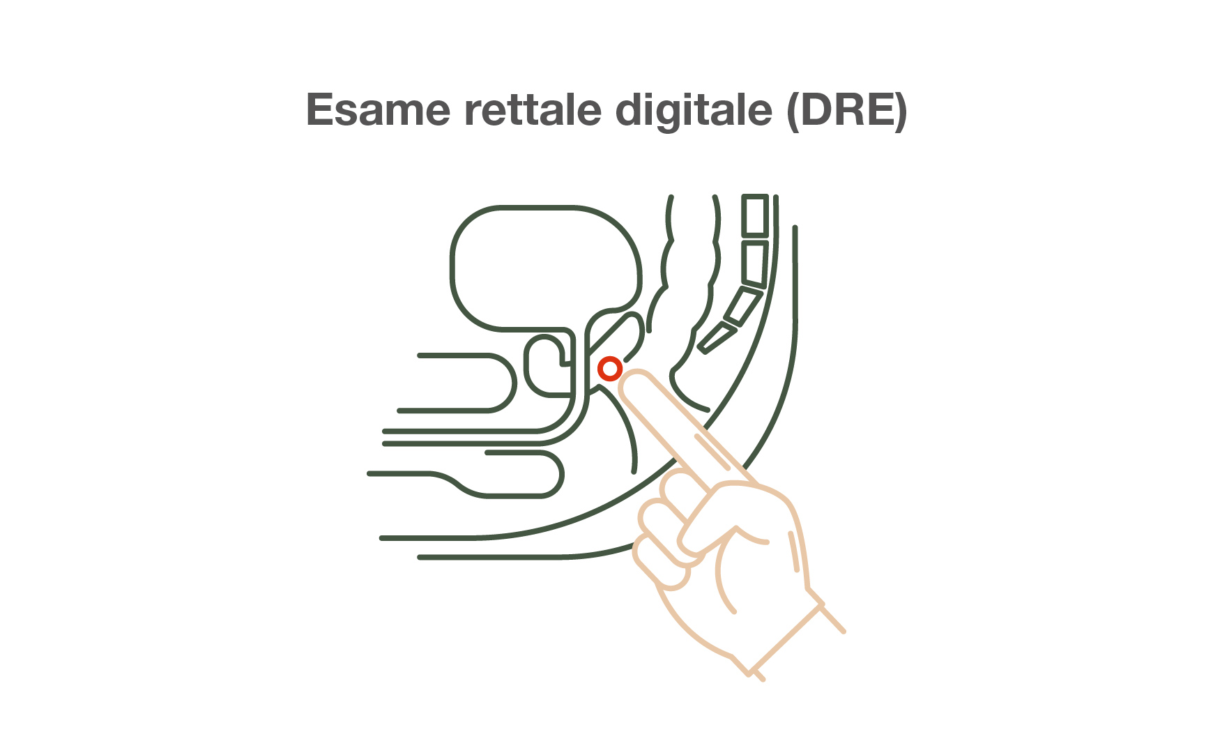 Esame rettale digitale (DER)