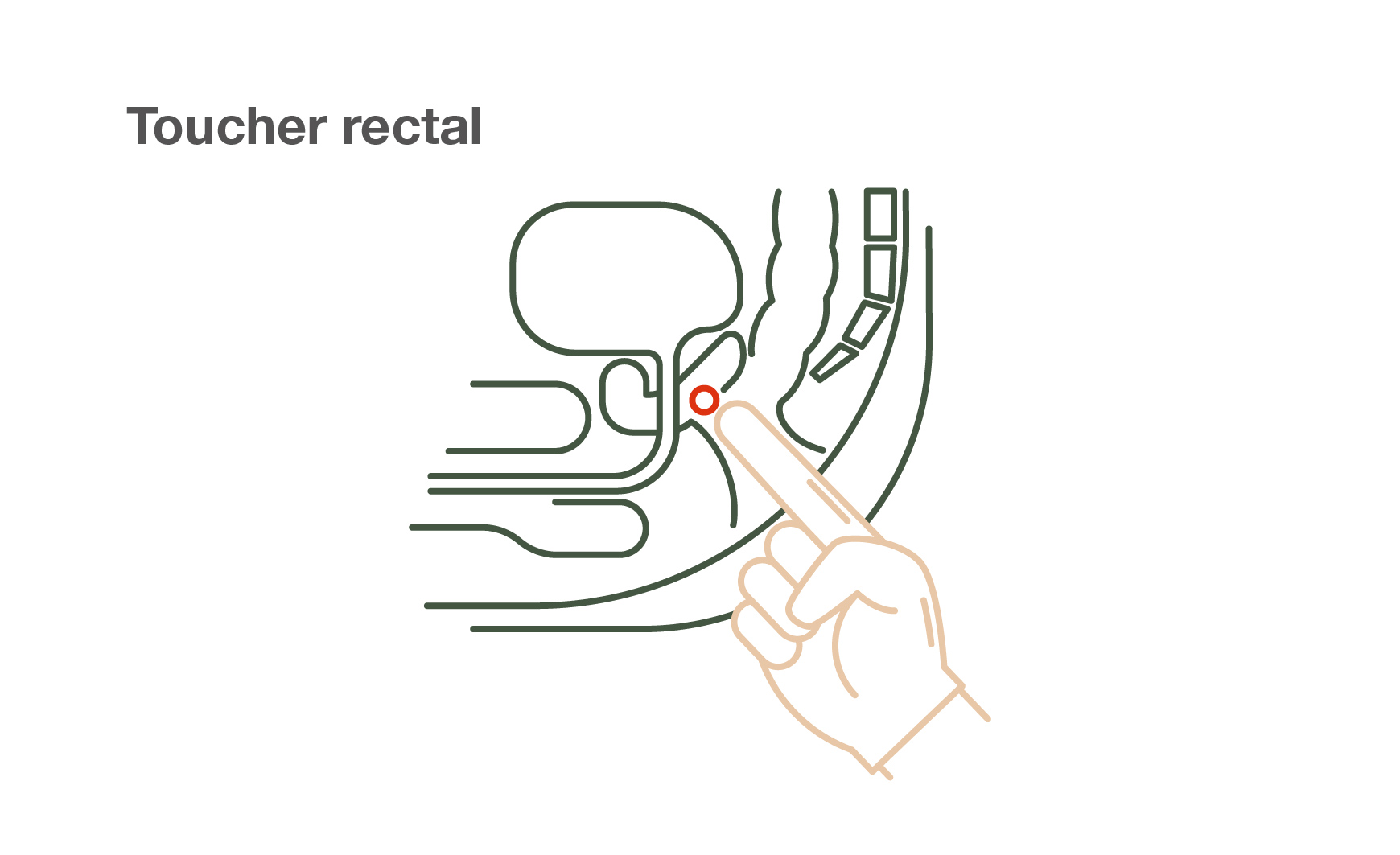 Toucher rectal