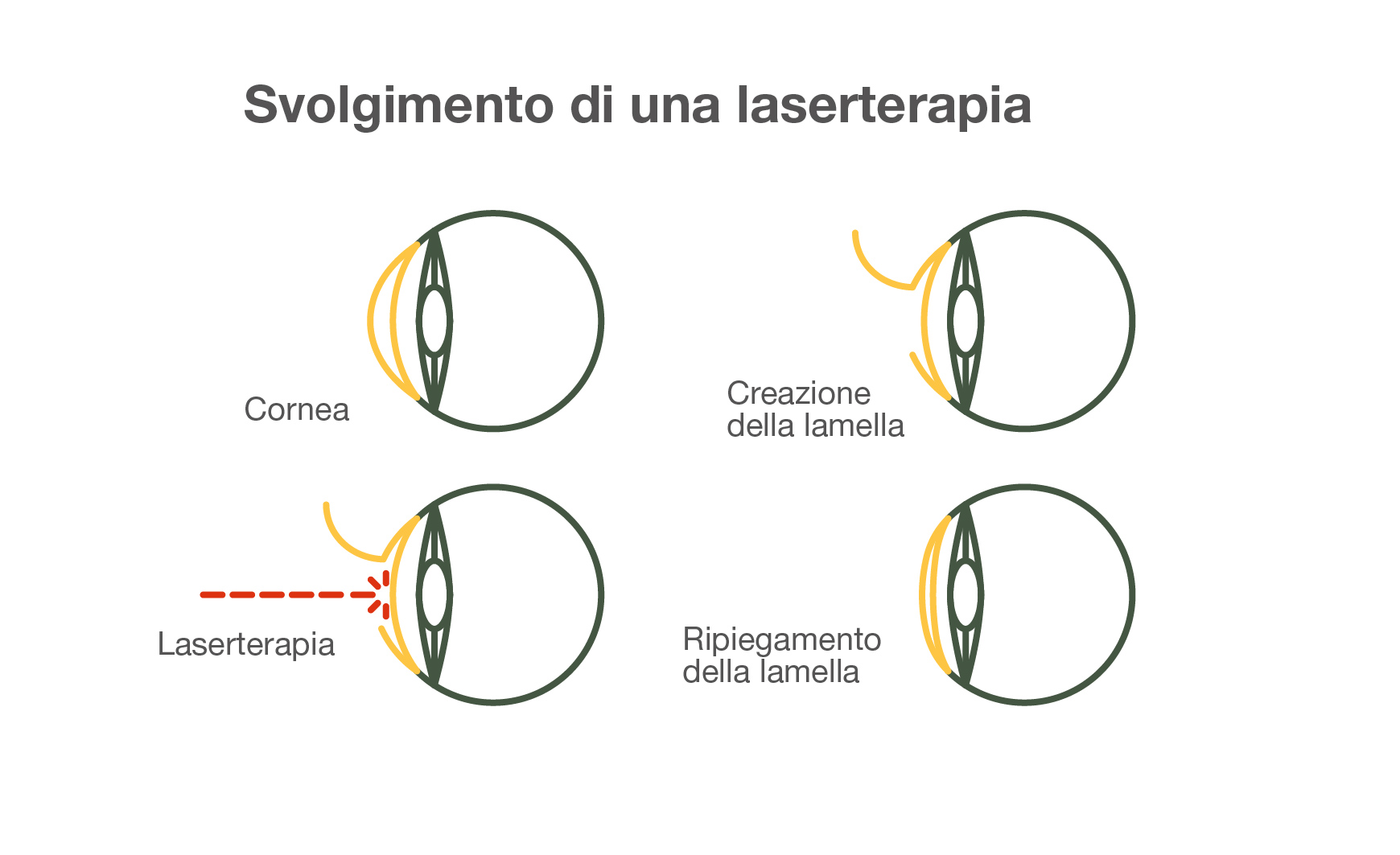 Svolgimento di una laserterapia