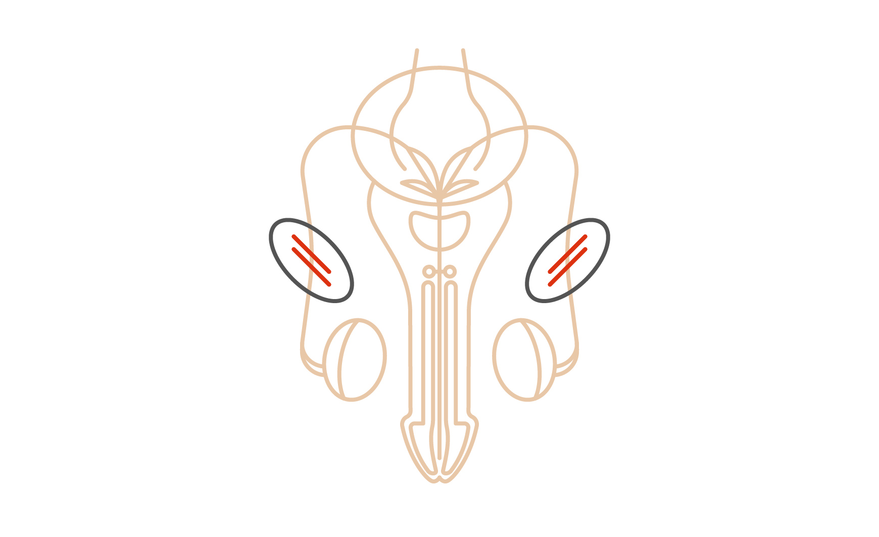 Darstellung einer Sterilisation beim Mann