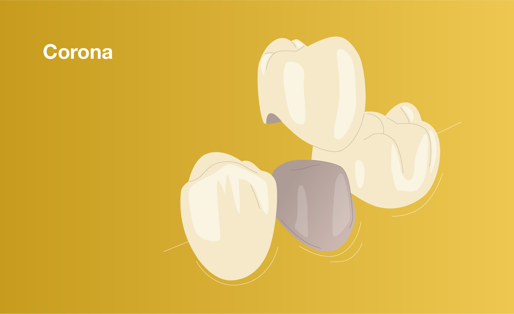Corona dentale