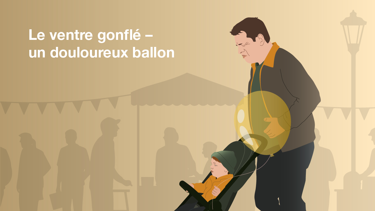 Illustration du type de ventre «ventre gonflé» : un homme avec un ventre ballonné et des maux de ventre se promène avec une poussette.