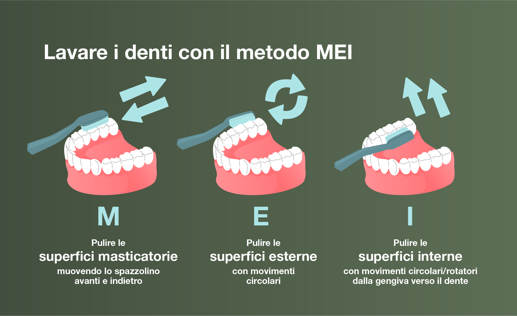 Illustrazione del metodo MEI per la pulizia dei denti.