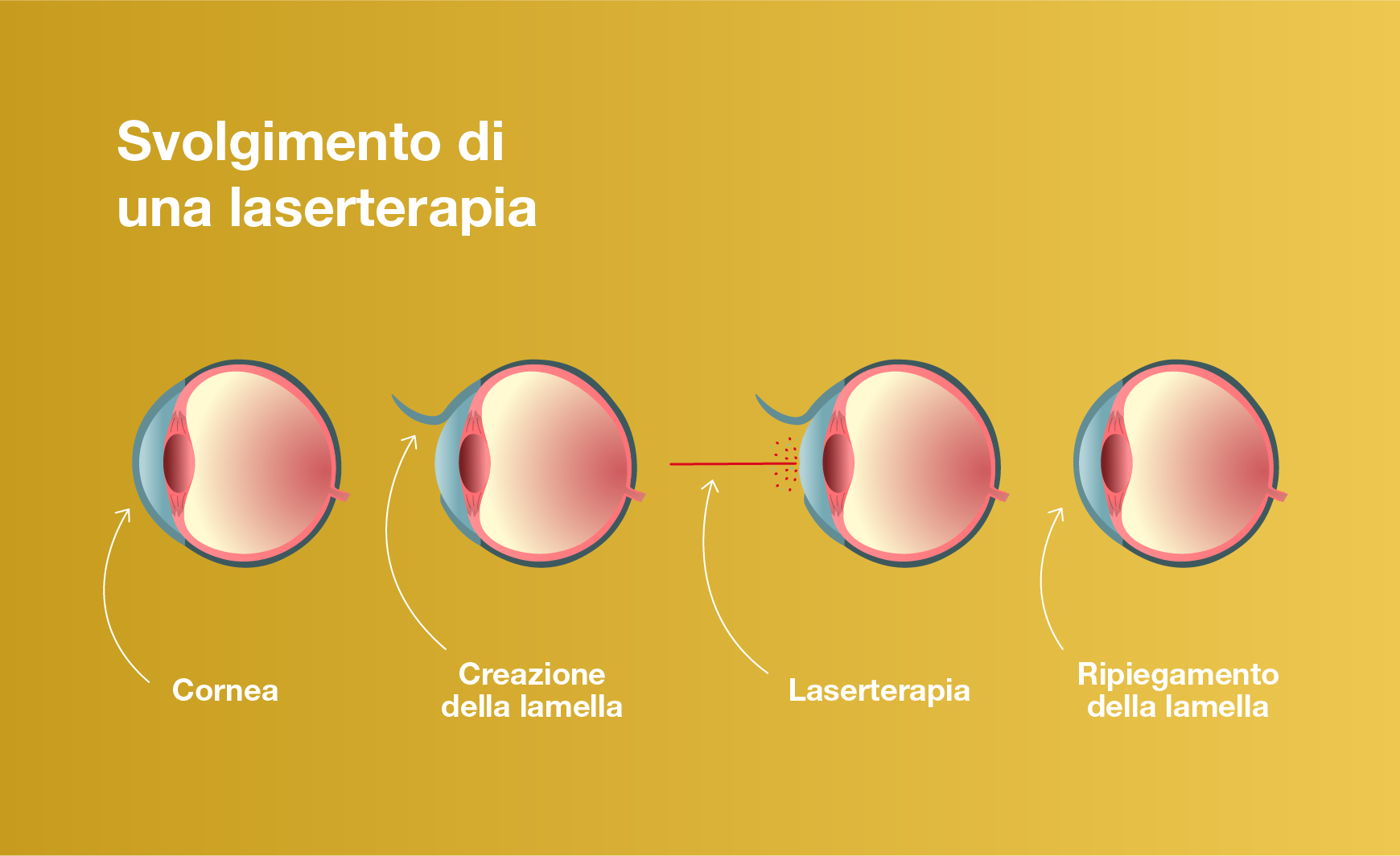 Svolgimento di una laserterapia