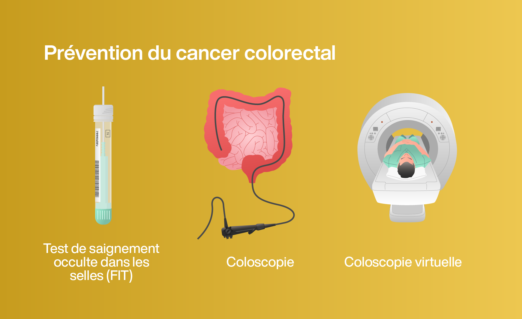 Les méthodes de dépistage du cancer du côlon