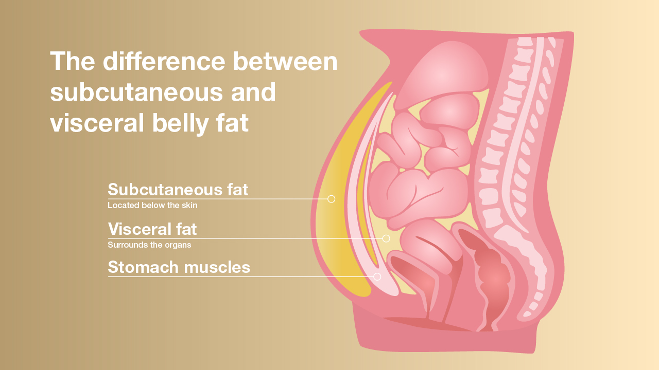 The difference between subcutaneous and visceral belly fat