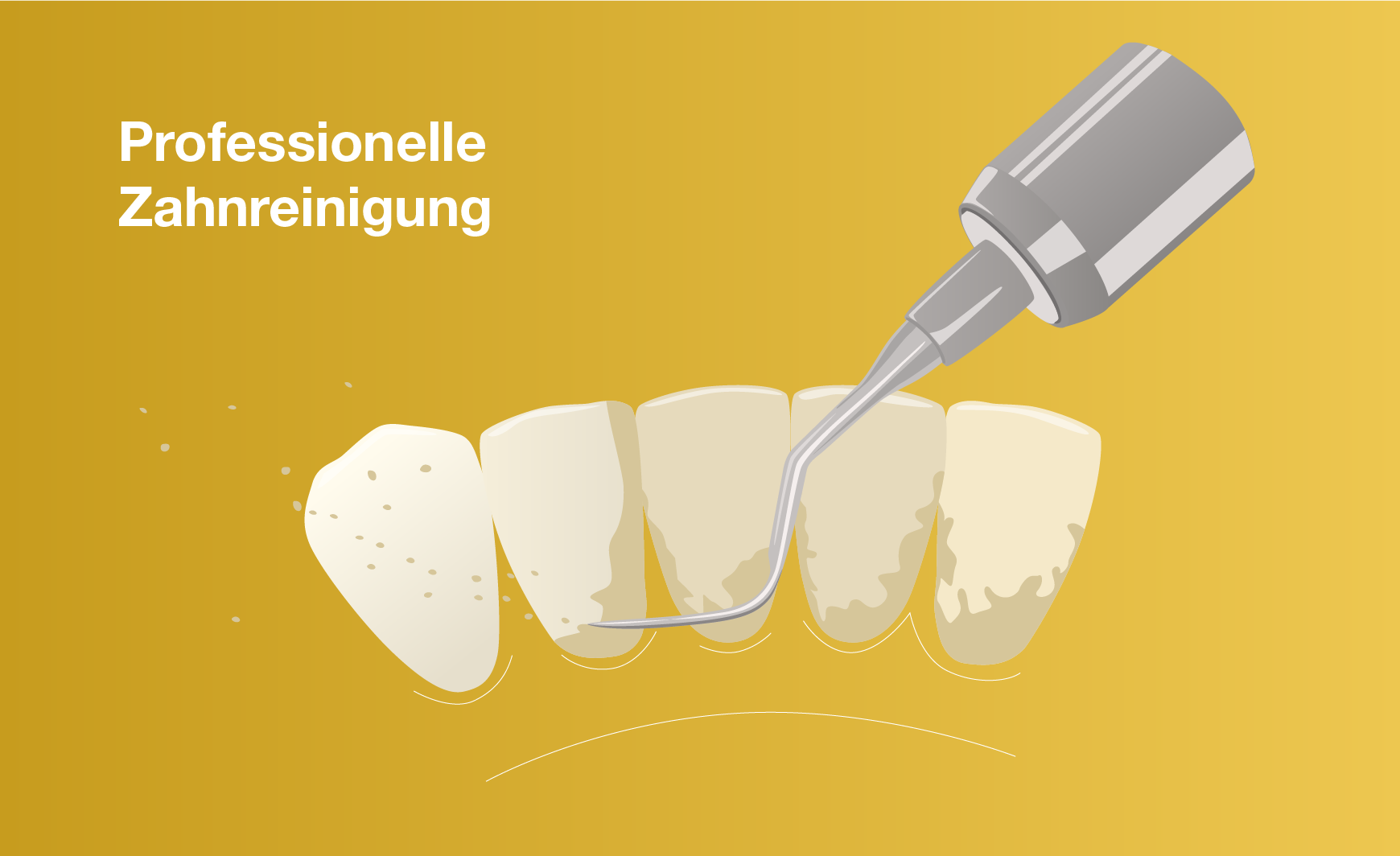 Professionelle Zahnreinigung