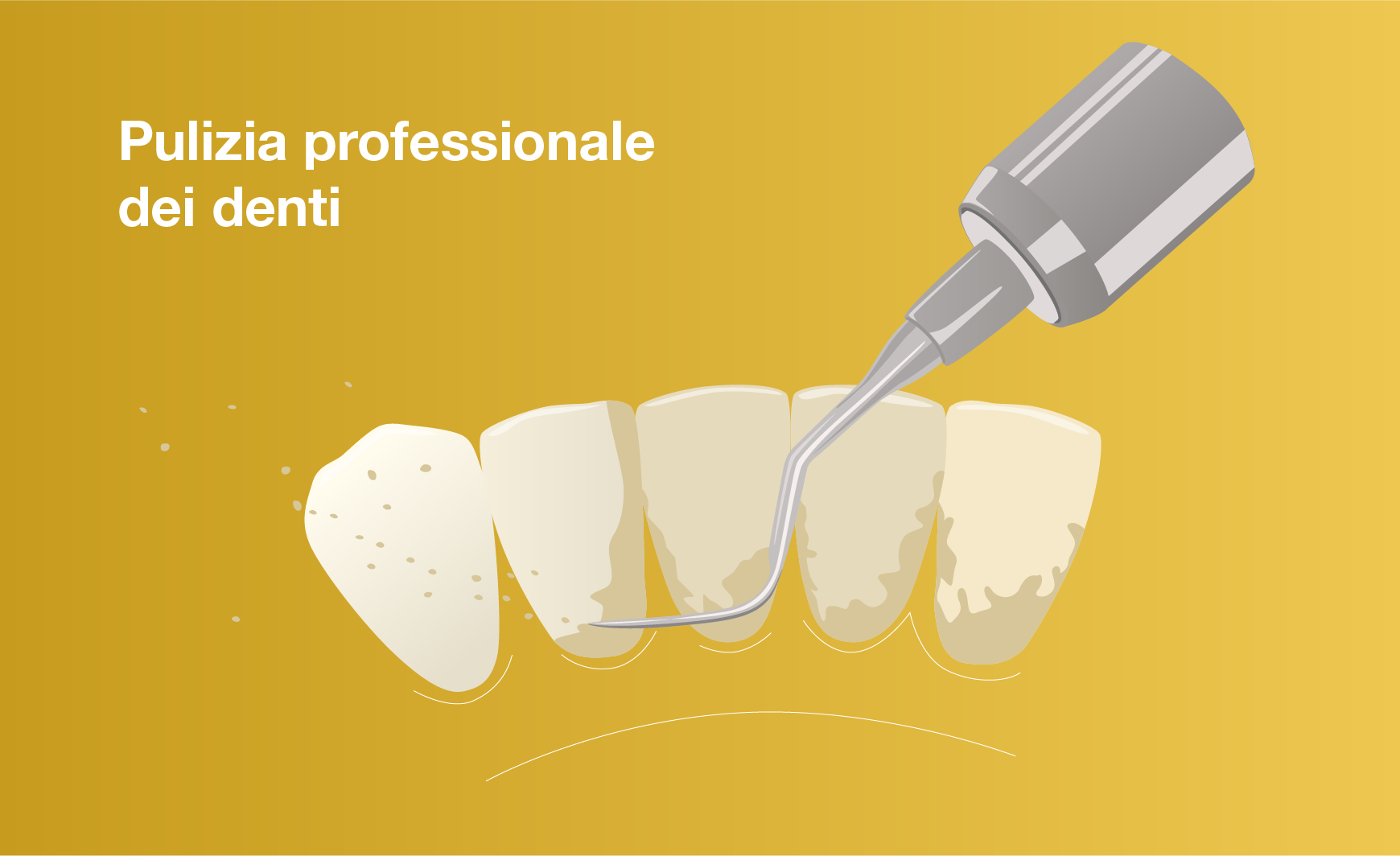 Pulizia professionale dei denti